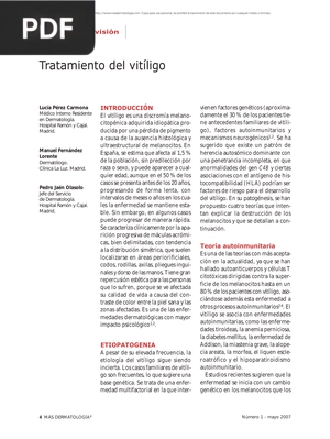 Tratamiento del vitíligo