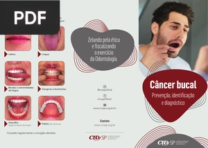Câncer bucal (Artigo)