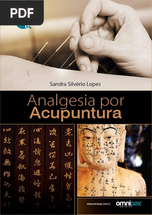 Analgesia por Acupuntura